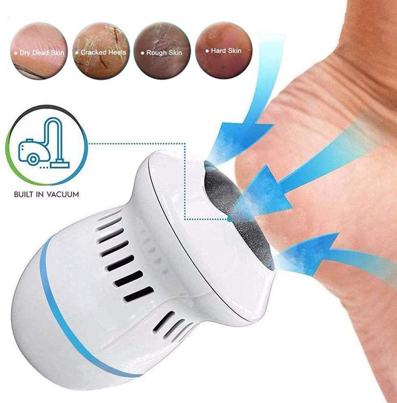 MeySmooth™ Electric Foot Grinder – The Ultimate Foot Care Tool You Didn't Know You Needed!