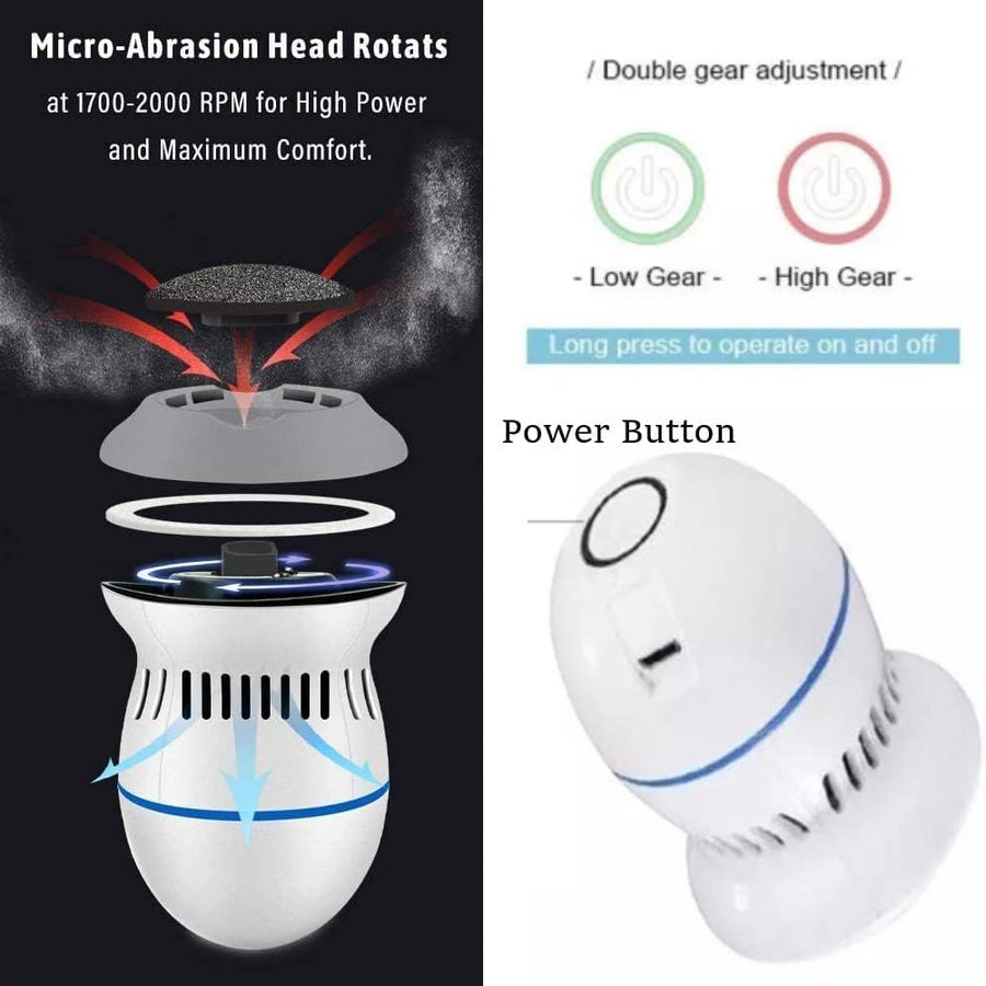 MeySmooth™ Electric Foot Grinder – The Ultimate Foot Care Tool You Didn't Know You Needed!